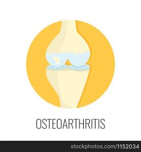 Osteoarthritis vector illustration. Medical icon. Osteoarthritis illustration. Medical icon