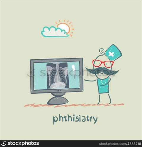 phthisiatry chest X-ray shows