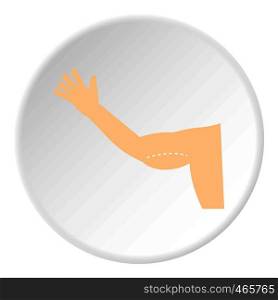 Plastic surgery of arm icon in flat circle isolated on white vector illustration for web. Plastic surgery of arm icon circle