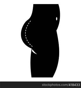 Plastic surgery of buttocks icon. Simple illustration of plastic surgery of buttocks vector icon for web. Plastic surgery of buttocks icon, simple style