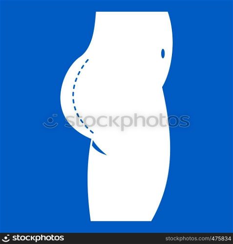 Plastic surgery of buttocks icon white isolated on blue background vector illustration. Plastic surgery of buttocks icon white