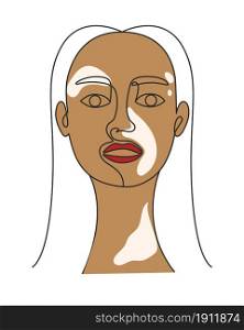 Portrait of a woman with vitiligo line art vector illustration. Adult beautiful girl with skin pigmentation. Hand drawing female silhouette.. Portrait of a woman with vitiligo line art vector illustration.