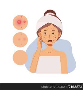 problem skin concept. Woman with pimples on her face,facial skin troubled. flat vector cartoon character illustration.
