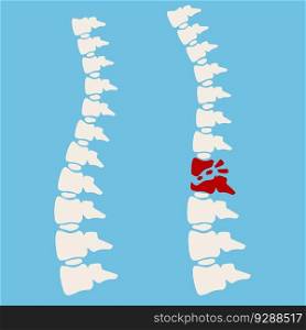 Problems with spine. Posture issues. Sick red place. Crack in White bone. Magnifying glass. Logo in circle. Vertebral column. X-ray of internal organs. Medical care. Fracture of intervertebral discs. Problems with spine. Posture issues