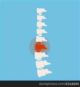 Problems with spine. Posture issues. Sick red place. Crack in White bone. Magnifying glass. Logo in circle. Vertebral column. X-ray of internal organs. Medical care. Fracture of intervertebral discs. Problems with spine. Posture issues