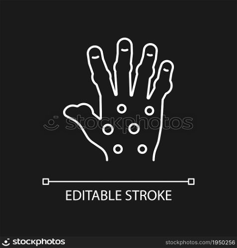 Psoriatic arthritis white linear icon for dark theme. Painful hand joints. Permanent bones damage. Thin line customizable illustration. Isolated vector contour symbol for night mode. Editable stroke. Psoriatic arthritis white linear icon for dark theme