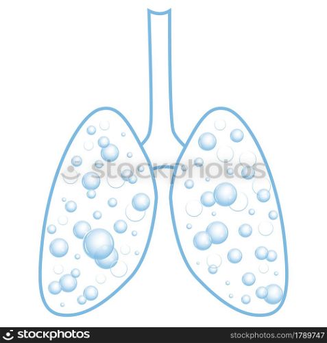 Pulmonary edema. Fluid in the respiratory organs. Bubbles in the lungs. Vector illustration isolated on white background.. Pulmonary edema. Fluid in the respiratory organs. Bubbles in the lungs. Vector illustration.