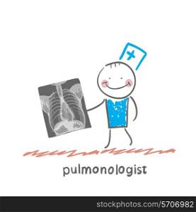pulmonologist with an X-ray of human lung