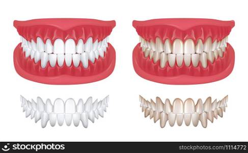 Realistic teeth. Isolated white 3D smile for orthodontics clinic, dentistry concept with white jaw render. Vector oral hygiene teeth model for denture or beauty smile illustration. Realistic teeth. Isolated white 3D smile for orthodontics clinic, dentistry concept with white jaw render. Vector oral hygiene teeth model