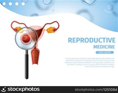 Reproductive Medicine. Magnifier Glass. Female Uterus. Extreme Close Up of Microscopic Sperm Swim to Female Egg to Fertilize for Pregnancy. Vector Realistic Illustration. Medical Banner. Copy Space. Sperm Swim to Female Egg. Female Uterus Banner