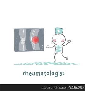 rheumatologist says about the pain in the joints of the feet and shows rengen