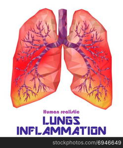 Sick human realistic lungs and trachea in low poly. Pleurisy, an inflammation around the lungs. Infection, tuberculosis, cancer, pulmonary embolism. Vector.