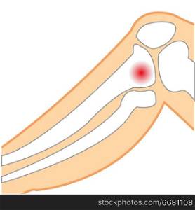 Sick knee of the person on white background is insulated. Vector illustration of the sick knee of the person