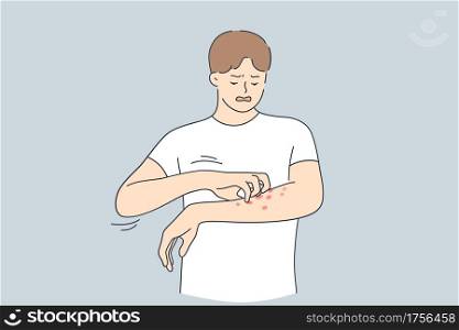 Skin allergy, Dermatitis, eczema concept. Annoyed young man in white t-shirt scratching itch on his arm feeling unhappy and uncomfortable vector illustration . Skin allergy, Dermatitis, eczema concept