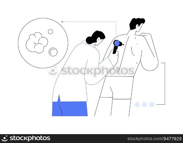 Skin cancer diagnosis abstract concept vector illustration. Doctor examines patient body using special equipment, skin cancer detection, medical examination, melanoma prevention abstract metaphor.. Skin cancer diagnosis abstract concept vector illustration.