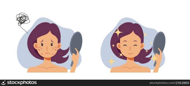 Skin care concept.woman,girl with acne.Before and after acne.Flat vector 2d cartoob character illustration.