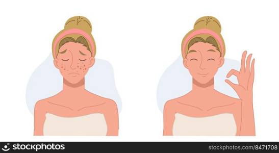 Skin care concept.woman,girl with acne.Before and after acne.Flat vector 2d cartoon character illustration.
