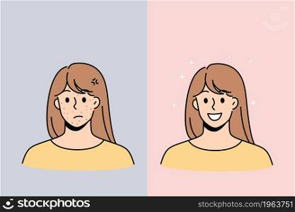 Skin problem and health concept. Stressed unhappy young woman with red acne pimples and smiling with healthy skin face vector illustration . Skin problem and health concept.