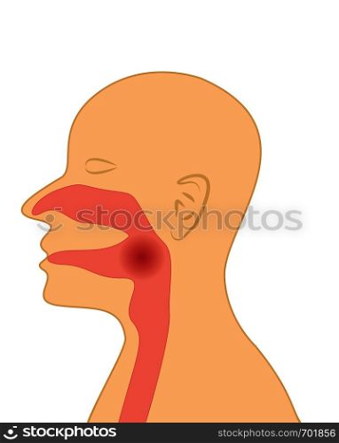 Sore throat vector illustration on a white background