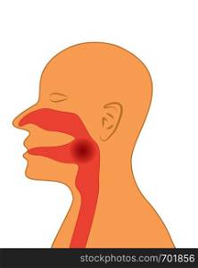 Sore throat vector illustration on a white background