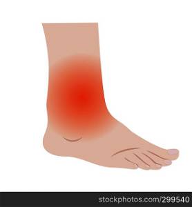Swelling of the feet and ankles from infected or injury vector illustration on a white background isolated