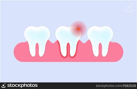 Teeth banner. Tooth with pain. Caries and toothache. Teeth care concept. Vector on isolated background. EPS 10.. Teeth banner. Tooth with pain. Caries and toothache. Teeth care concept. Vector on isolated background. EPS 10