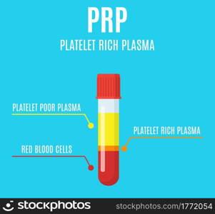 Test tube filled with blood after centrifuge for PRP injection procedures. Platelet-rich plasma laboratory equipment. Regenerative medicine concept. Vector illustration in flat style. Test tube filled with blood
