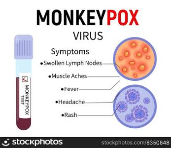 Test tube with blood for monkeypox virus test, human skin s&le with rash and virus cells on white background. Symptoms of monkeypox. Vector illustration.. Test tube with blood for monkeypox virus test