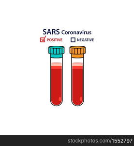 Test tube with blood sample positive SARS cronovirus