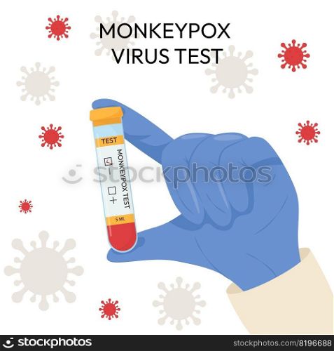 The hand of a doctor in a protective glove holds a test tube. Monkeypox virus test. Positive or negative test. Test systems. The hand of a doctor in a protective glove holds a test tube. Monkeypox virus test. Positive or negative test. Test systems.