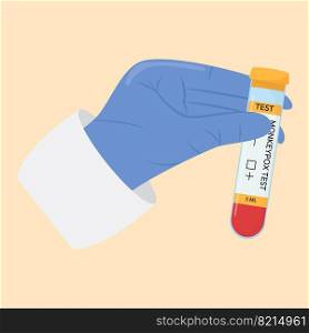 The hand of a doctor in a protective glove holds a test tube. Monkeypox virus test. Positive or negative test. Test systems. The hand of a doctor in a protective glove holds a test tube. Monkeypox virus test. Positive or negative test. Test systems.