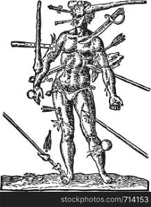 The Man of Wounds old engraving Illustration from the Opera Chirurgica, by Ambroise ParA 1594. Shows a man with multiple wounds made by weapons, such as sword, arrow, club, lance, canonball and dagger.
