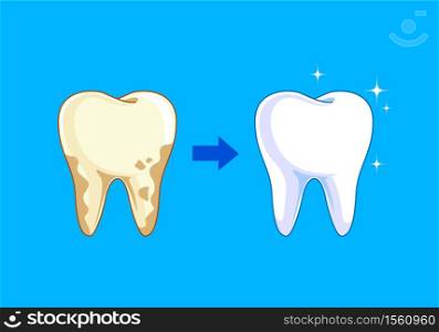 Tooth before and after. Yellow becomes white, Dental care concept, illustration isolated on blue background.