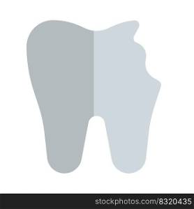 Tooth repair with chipped on side isolated on a white background