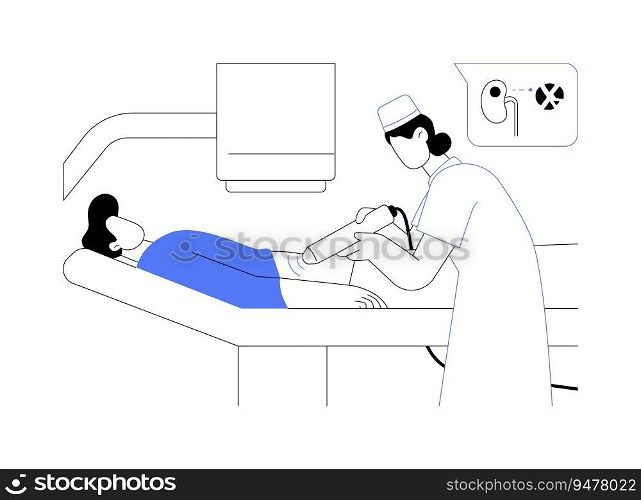 Treatment of urethral stones abstract concept vector illustration. Doctor deals with non-invasive extracorporeal shock wave lithotripsy, kidney stones treatment, urology sector abstract metaphor.. Treatment of urethral stones abstract concept vector illustration.