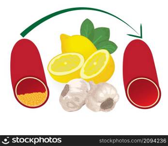 Turning high level of atherosclerotic plaque in blood vessel into normal level with healthy meal like lemon amd garlic medical vector infographics on a white background