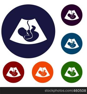 Ultrasound fetus icons set in flat circle reb, blue and green color for web. Ultrasound fetus icons set