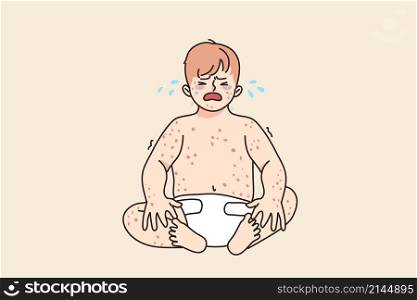 Unhappy baby infant crying suffer from eczema or dermatology disease. Upset sad little kid newborn child stressed with measles or chickenpox. Children healthcare concept. Vector illustration. . Unhappy baby crying suffer from eczema disease