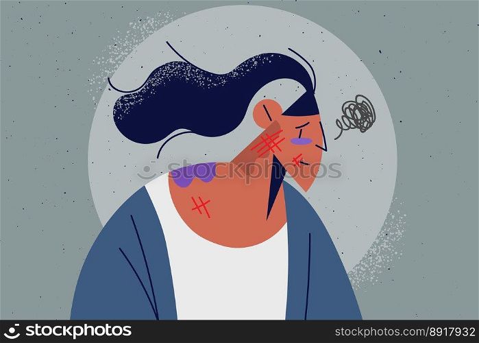 Unhappy woman with bruises and scratches suffer from domestic violence. Distressed girl struggle with violent behavior. Victim of harassment or bullying. Vector illustration. . Unhappy woman with bruises and beatings 