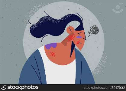 Unhappy woman with bruises and scratches suffer from domestic violence. Distressed girl struggle with violent behavior. Victim of harassment or bullying. Vector illustration. . Unhappy woman with bruises and beatings 
