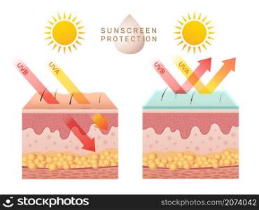 Uv skin protection. Damaged human skin peels before and after sun protection body adipose layers epidermis recent vector infographic template. Uv sunburn, ultraviolet to body damage illustration. Uv skin protection. Damaged human skin peels before and after sun protection body adipose layers epidermis recent vector infographic template