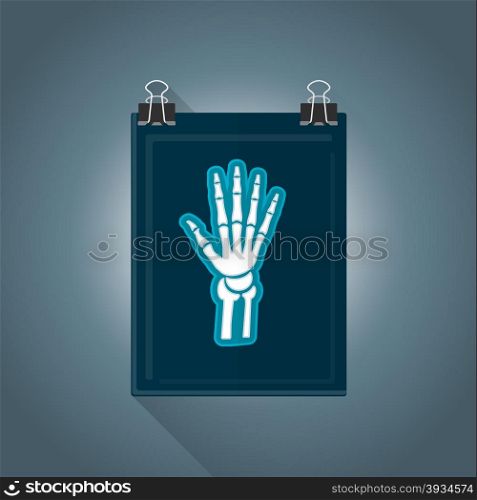 vector colored flat design x-ray radiography hand picture illustration isolated dark background long shadow&#xA;