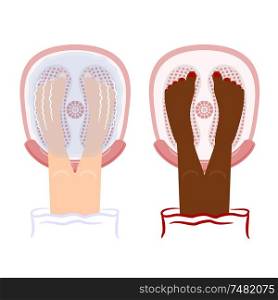 Vector illustration of a whirlpool bath and cosmetic procedures. Female legs in the whirlpool bath. Cartoon style