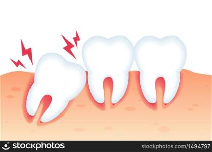 Vector Illustration Pain from Wrong Bite Flat. Dental Diseases and Pain from Abnormal Tooth Growth. Crooked Teeth or Malocclusion. Specialized Orthodontic Care. Dental Pathology Poster.