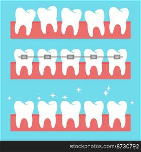 vector toothbrush over healthy and shiny teeth. dental tooth caries. orthodontic tooth brace. flat style icons