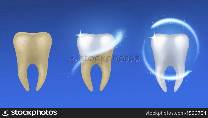 Whitening tooth. Realistic white and yellow teeth before and after enamel treatment, dental care and protection, oral hygiene poster vector concept isolated on blue background. Whitening tooth. Realistic teeth before and after enamel treatment, dental care and protection, oral hygiene poster vector concept