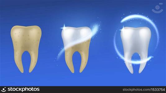 Whitening tooth. Realistic white and yellow teeth before and after enamel treatment, dental care and protection, oral hygiene poster vector concept isolated on blue background. Whitening tooth. Realistic teeth before and after enamel treatment, dental care and protection, oral hygiene poster vector concept