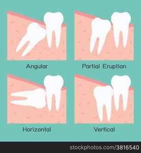 Wisdom tooth, vector