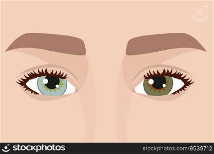 Woman eyes with a heterochromia. Woman with different colored eyes. Eyes of different colors. Blue and green eye. Vector illustration