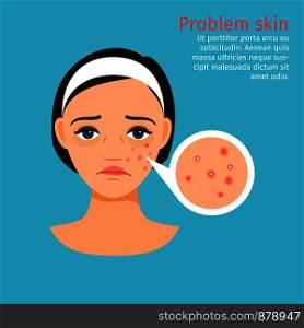 Woman face problem skin with acne, vector illustration. Woman face problem skin with acne